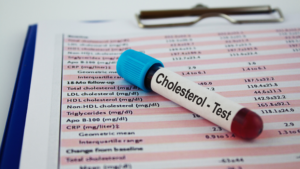 cholesterol test report